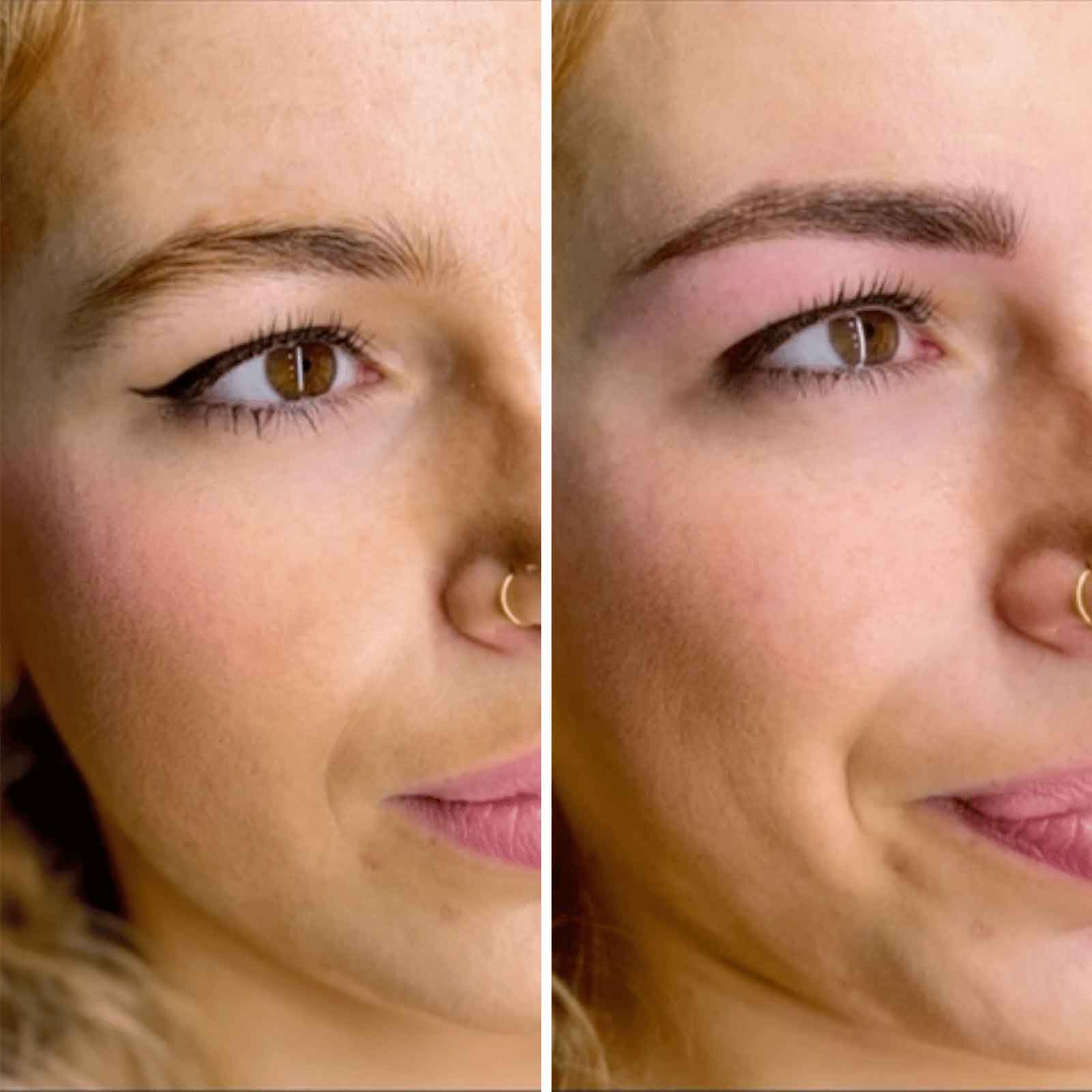 Antes y después 2