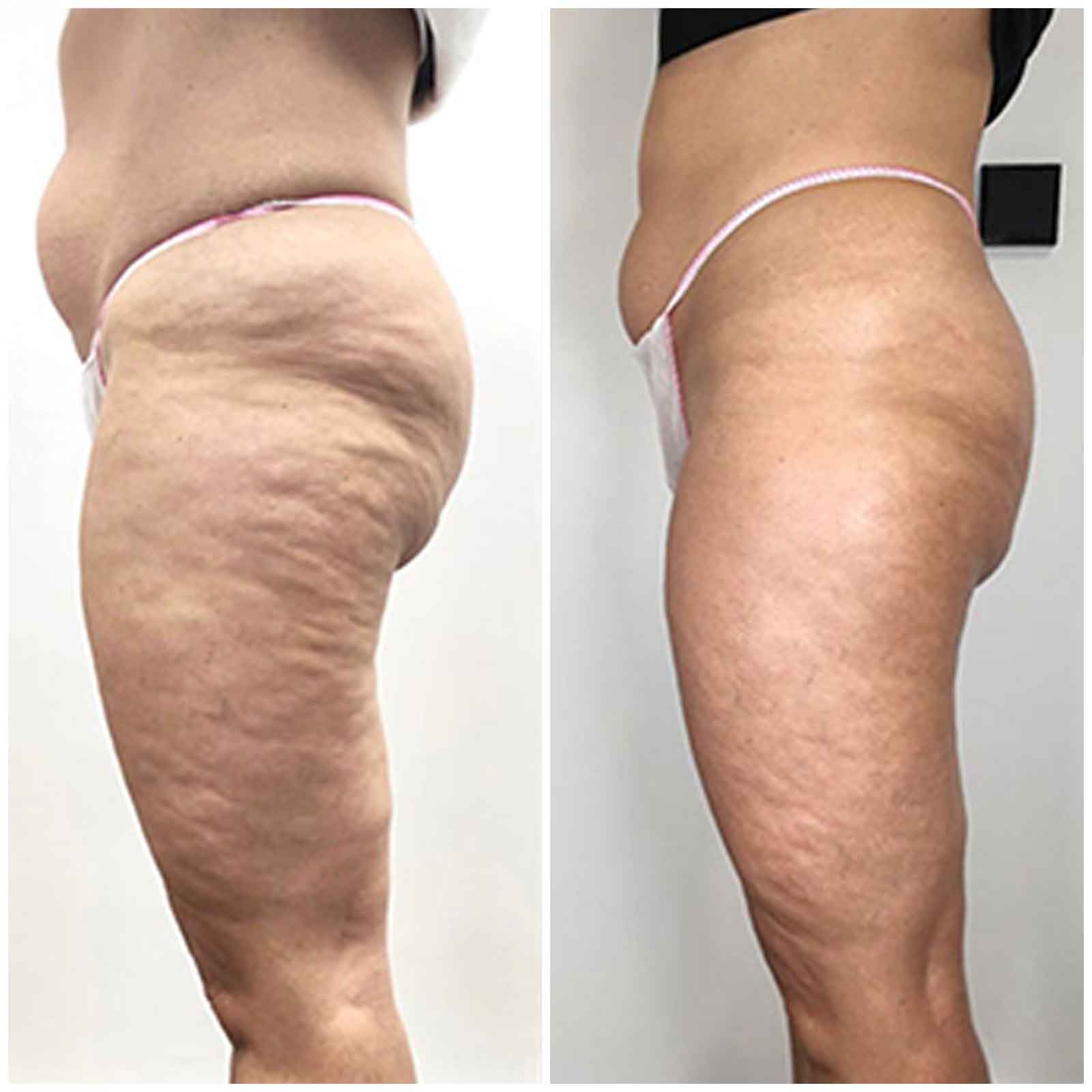 Antes y después 3