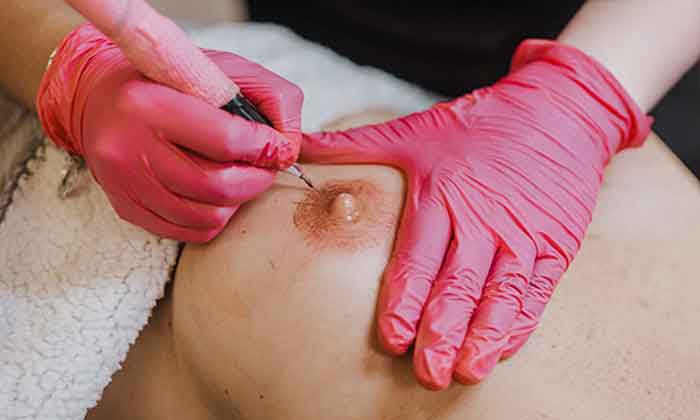 Estética paramédica en Zen Abando